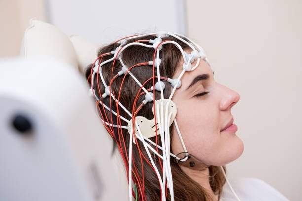 تخطيط المخ EEG في عيادة مخ وأعصاب لتشخيص نوبات الصرع والاضطرابات العصبية
